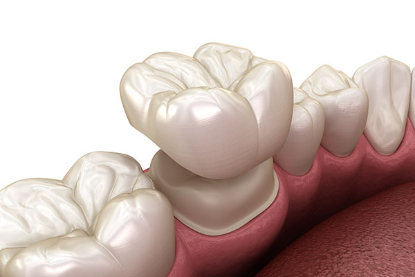 What Can Dental Crowns Do for Your Oral Health Issues? from Titan Dental Care in Sterling, VA