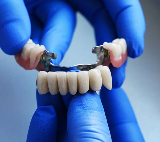 Sterling Dental Bridges