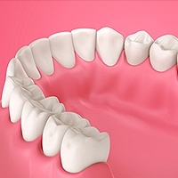 Gum Disease Sterling, VA