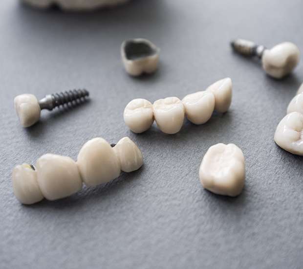 Sterling The Difference Between Dental Implants and Mini Dental Implants