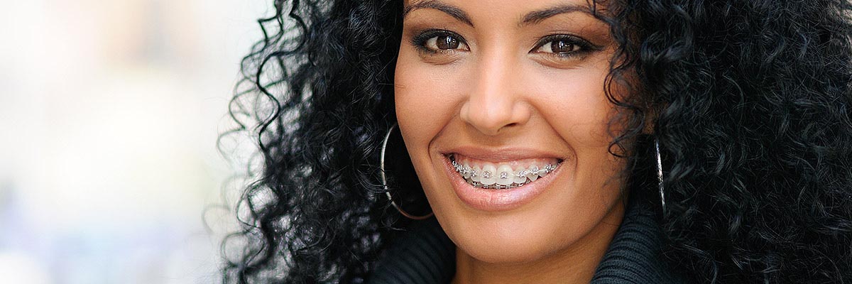 Sterling Orthodontic Services
