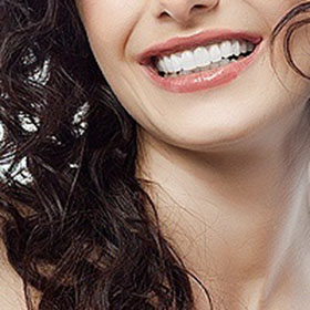 Five Common Types Of Adult Braces